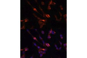 Immunofluorescence analysis of NIH/3T3 cells using FKBP5 antibody.