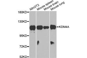 Western blot analysis of extracts of various cell lines, using KDM4A antibody. (KDM4A Antikörper)