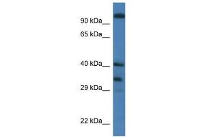 WB Suggested Anti-Morf4l1 Antibody   Titration: 1. (MORF4L1 Antikörper  (Middle Region))