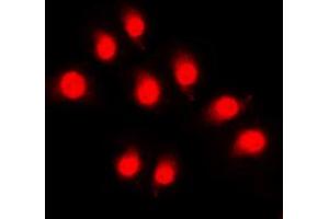 Immunofluorescent analysis of Rpb1 CTD (pSer5) staining in HeLa cells. (Rpb1 CTD Antikörper  (C-Term, pSer5))