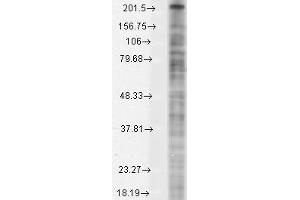 Nav1 8 Cos1 8 transient Western Blotting. (Nav1.8 Antikörper  (AA 1724-1956))