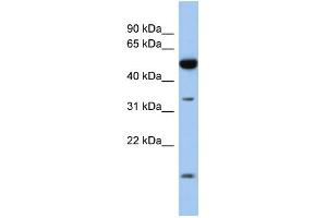 WB Suggested Anti-RDH12 Antibody Titration: 0. (RDH12 Antikörper  (Middle Region))