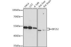 Western blot analysis of extracts of various cell lines, using EIF2S2 Rabbit pAb  at 1:3000 dilution. (EIF2S2 Antikörper  (AA 1-175))