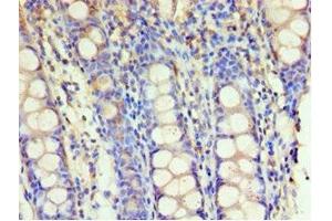 Immunohistochemistry of paraffin-embedded human colon tissue using ABIN7154112 at dilution of 1:100 (GSTM4 Antikörper  (AA 1-218))