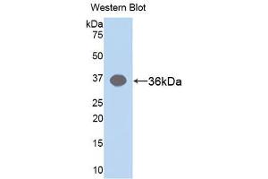 Western blot analysis of the recombinant protein. (ARG Antikörper)