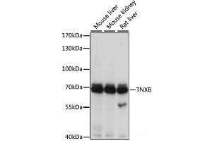 Western blot analysis of extracts of various cell lines using TNXB Polyclonal Antibody at dilution of 1:1000. (TNXB Antikörper)