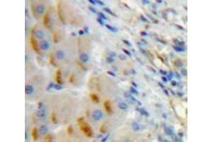 IHC-P analysis of Liver tissue, with DAB staining. (CD79a Antikörper  (AA 30-193))