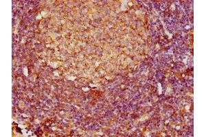 IHC image of ABIN7158533 diluted at 1:800 and staining in paraffin-embedded human lymph node tissue performed on a Leica BondTM system. (FCER2 Antikörper  (AA 48-321))