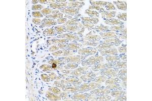 Immunohistochemistry of paraffin-embedded mouse stomach using IL6 antibody at dilution of 1:100 (40x lens). (IL-6 Antikörper)