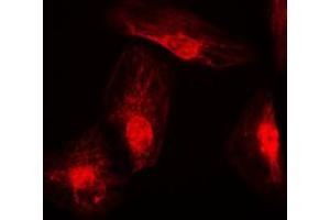 Immunofluorescent analysis of RANBP6 staining in K562 cells. (RANBP6 Antikörper  (Center))