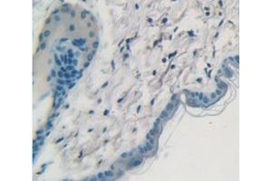 Figure. (Cytokeratin 1 Antikörper  (AA 189-497))