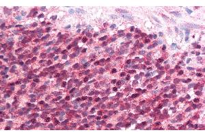 Immunohistochemistry (IHC) image for anti-Inducible T-Cell Co-Stimulator Ligand (ICOSLG) (AA 23-249) antibody (ABIN7439975)