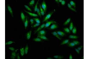 Immunofluorescence staining of Hela cells with ABIN7159428 at 1:100, counter-stained with DAPI. (Mesothelin Antikörper  (AA 37-598))