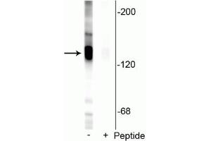 Western Blotting (WB) image for anti-Solute Carrier Family 12 (Potassium-Chloride Transporter) Member 5 (SLC12A5) (pSer940) antibody (ABIN6254065)