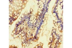 Immunohistochemistry of paraffin-embedded human small intestine tissue using ABIN7163928 at dilution of 1:100 (KCNK16 Antikörper  (AA 259-309))