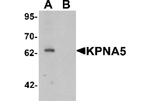Western blot analysis of KPNA6 in EL4 cell lysate with KPNA5 antibody at 1 µg/mL in (A) the absence and (B) the presence of blocking peptide. (KPNA5 Antikörper  (N-Term))