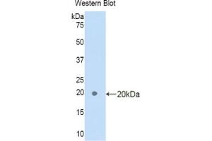 Western blot analysis of the recombinant protein. (FAM132A Antikörper  (AA 92-241))