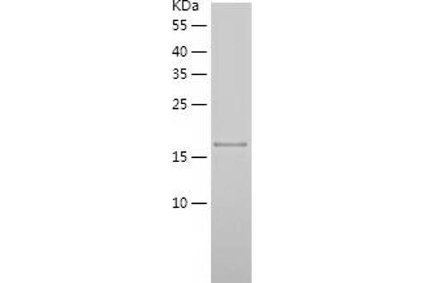 OMP Protein (AA 2-163) (His tag)