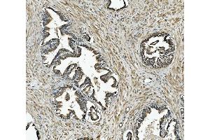 IHC analysis of NDUFB10 using anti-NDUFB10 antibody (ABIN7601461).