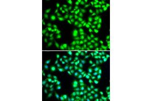 Immunofluorescence analysis of A-549 cells using YTHDC1 antibody. (YTHDC1 Antikörper  (AA 260-500))