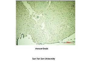 Immunohistochemistry (IHC) analysis:Please contact us for more details. (TH Antikörper  (Tyr161))
