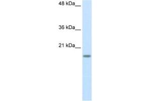 Western Blotting (WB) image for anti-Ribosomal Protein S14 (RPS14) antibody (ABIN2462095) (RPS14 Antikörper)