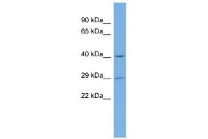 NAT15 antibody used at 1 ug/ml to detect target protein. (NAT15 Antikörper)