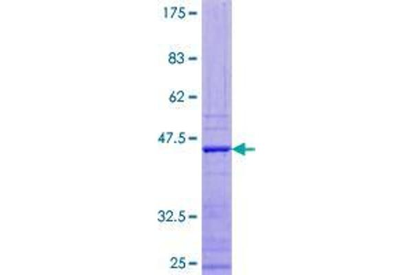 APOBEC3F Protein (AA 1-101) (GST tag)