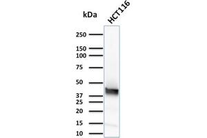 Western Blotting (WB) image for anti-Keratin 15 (KRT15) antibody (ABIN6939913)