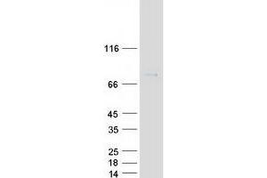 Western Blotting (WB) image for Fragile X Mental Retardation 1 (FMR1) protein (Myc-DYKDDDDK Tag) (ABIN2721259)