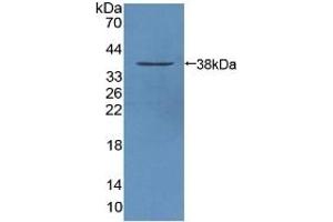 Western Blotting (WB) image for anti-Signal Transducing Adaptor Molecule (SH3 Domain and ITAM Motif) 1 (STAM) (AA 199-464) antibody (ABIN7442921)
