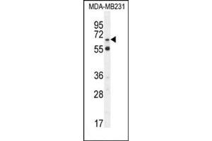 Western blot analysis in MDA-MB231 cell line lysates (35 µg/lane) using S6A12 Antibody (N-term) Cat. (SLC6A12 Antikörper  (N-Term))