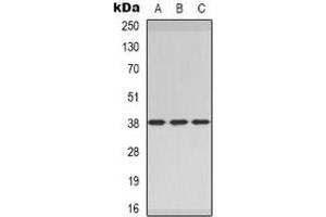 Western blot analysis of CER1 expression in MCF7 (A), rat heart (B), rat brain (C) whole cell lysates. (CER1 Antikörper)