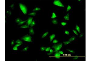 Immunofluorescence of monoclonal antibody to FTCD on HepG2 cell. (FTCD Antikörper  (AA 440-541))