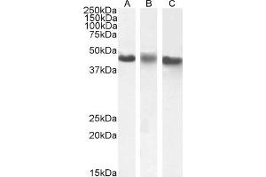 ABIN238540 (1 μg/mL) staining of A431(A), HeLa (B) and K562 (C) nuclear cell lysate (35 μg protein in RIPA buffer).