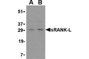 Western Blotting (WB) image for anti-Tumor Necrosis Factor (Ligand) Superfamily, Member 11 (TNFSF11) (Middle Region) antibody (ABIN1031107) (RANKL Antikörper  (Middle Region))