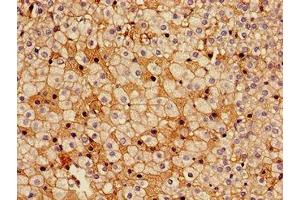 Immunohistochemistry of paraffin-embedded human adrenal gland tissue using ABIN7142312 at dilution of 1:100 (HSD17B7 Antikörper  (AA 128-198))
