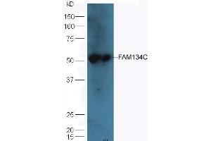 Mouse liver lysates probed with Rabbit Anti-FAM134C Polyclonal Antibody (ABIN872917) at 1:300 overnight in 4 °C. (FAM134C Antikörper  (AA 76-180))