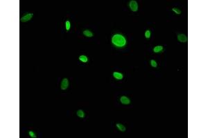 Immunofluorescence staining of U251 cells with ABIN7146450 at 1:133, counter-stained with DAPI. (CACYBP Antikörper  (AA 2-228))