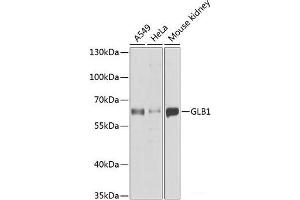 Western blot analysis of extracts of various cell lines using GLB1 Polyclonal Antibody at dilution of 1:1000. (GLB1 Antikörper)