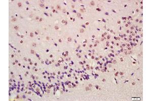 Immunohistochemistry (IHC) image for anti-Activating Transcription Factor 4 (Tax-Responsive Enhancer Element B67) (ATF4) (AA 251-351) antibody (ABIN687862)