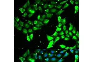 Immunofluorescence analysis of A549 cells using KIF2B Polyclonal Antibody (KIF2B Antikörper)