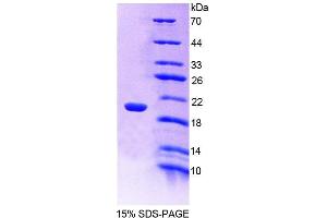 SDS-PAGE analysis of Mouse CREG1 Protein. (CREG1 Protein)