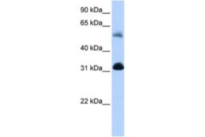 Western Blotting (WB) image for anti-3-Oxoacid CoA Transferase 1 (OXCT1) antibody (ABIN2463187) (OXCT1 Antikörper)