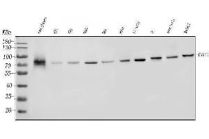 Western blot analysis of YTHDC1 using anti-YTHDC1 antibody (ABIN7601331).