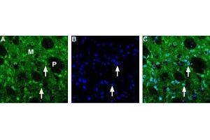 Expression of Choline transporter in rat striatum - Immunohistochemical staining of rat frozen brain sections using Anti-Choline Transporter (SLC5A7) (extracellular) Antibody (ABIN7043267 and ABIN7044218) (1:200). (ChT Antikörper  (Extracellular))