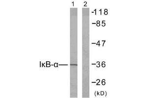 Western blot analysis of extracts from 293 cells untreated or treated with TNF-α (20ng/ml, 30min), using IκB-α (Ab-42) antibody (E021176). (NFKBIA Antikörper)