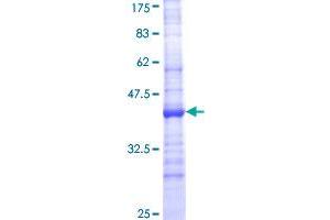 CYP24A1 Protein (AA 415-514) (GST tag)