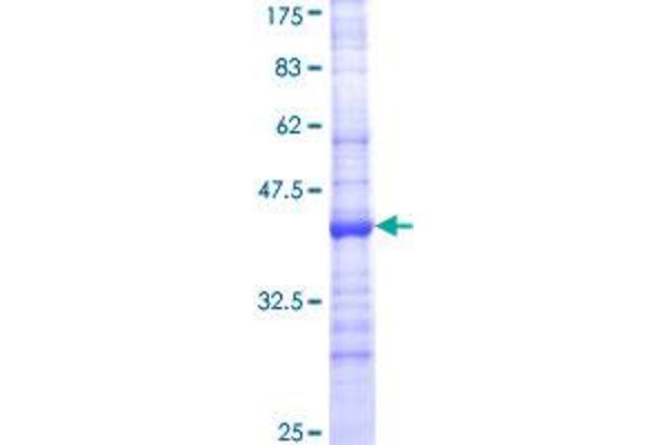 CYP24A1 Protein (AA 415-514) (GST tag)