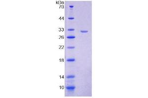 SDS-PAGE analysis of Mouse VARS Protein. (VARS Protein)